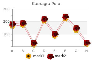 safe kamagra polo 100mg