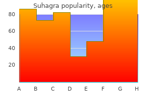 order suhagra with mastercard