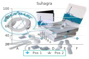 suhagra 50 mg cheap