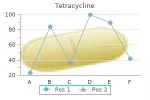 buy 250 mg tetracycline mastercard